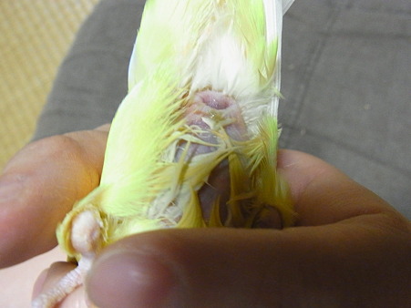 出産後のおなか1